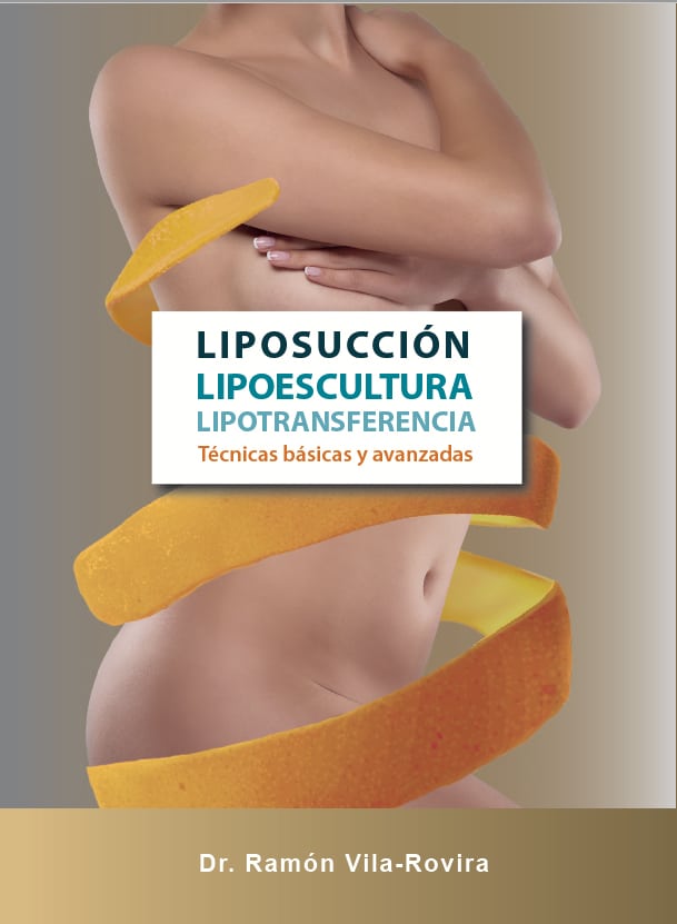Liposucción Lipoescultura, Lipotransferencia. Técnicas básicas y avanzadas