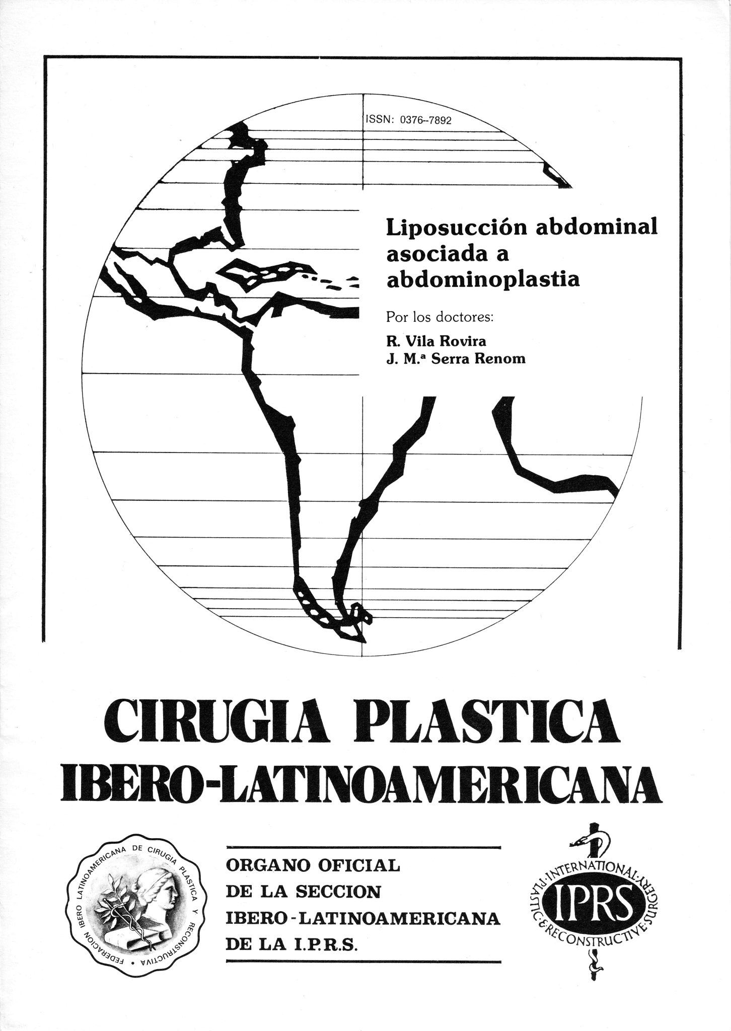 Liposucción abdominal asociada a abdominoplastia