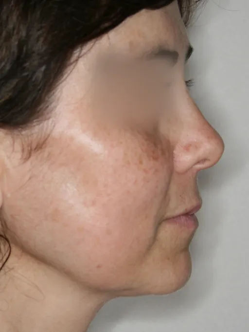 Después - corporales